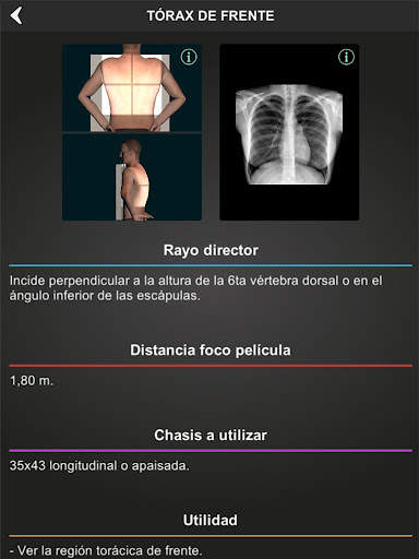 RX - Posiciones Radiológicas screenshot 8