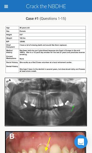 NBDHE - Dental Hygiene Prep screenshot 2
