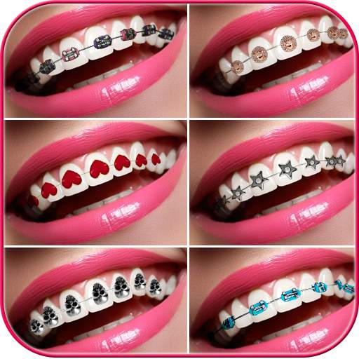 Braces Photo Editor 0.2
