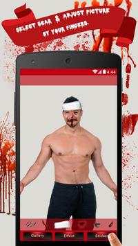 Injury Photo Editor screenshot 6