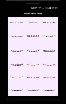 Braces Photo Editor Beauty screenshot 2