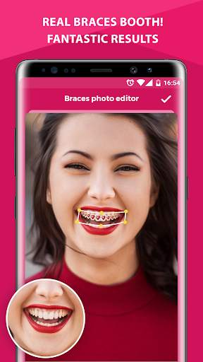Braces Photo Editor screenshot 1