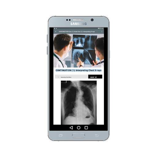 X-ray Interpretation for Medic screenshot 3
