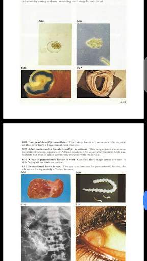 Atlas Of Tropical Medicine And Parasitology screenshot 3