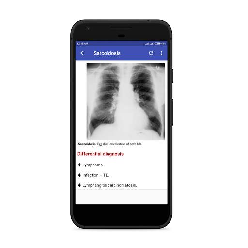 Chest Radiology 7 تصوير الشاشة