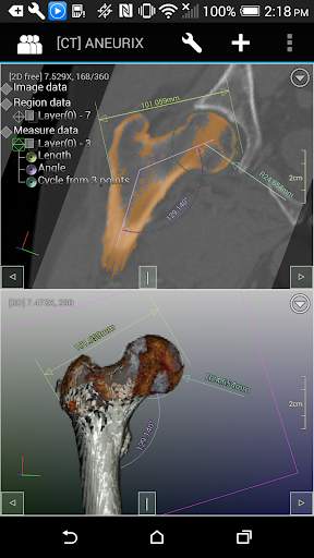 DroidRender - 3D DICOM viewer स्क्रीनशॉट 3