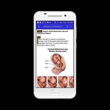 Obstetrics Mnemonics screenshot 4