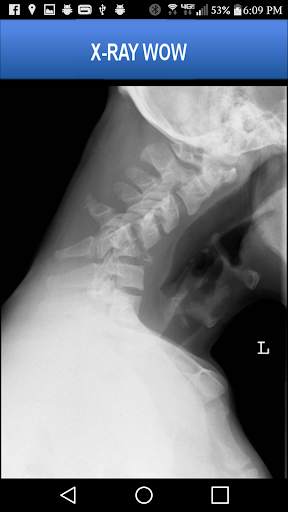 X-RAY WOW screenshot 8