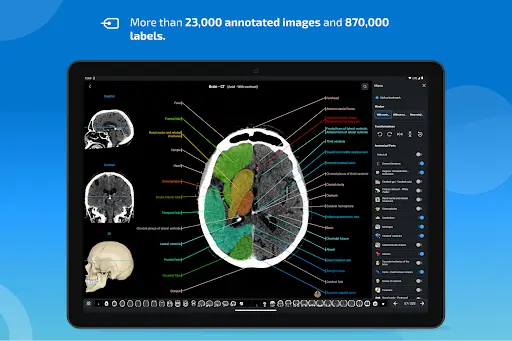 e-Anatomy screenshot 10