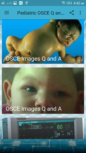 Pediatrics  OSCE Q and A screenshot 2