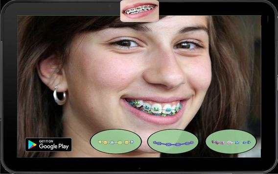 Real Braces Teeth Booth Pro screenshot 5