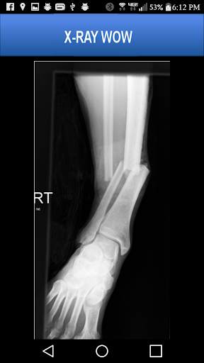 X-RAY WOW screenshot 5
