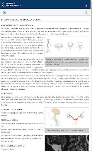 LA APP DE LA COLUMNA VERTEBRAL screenshot 3