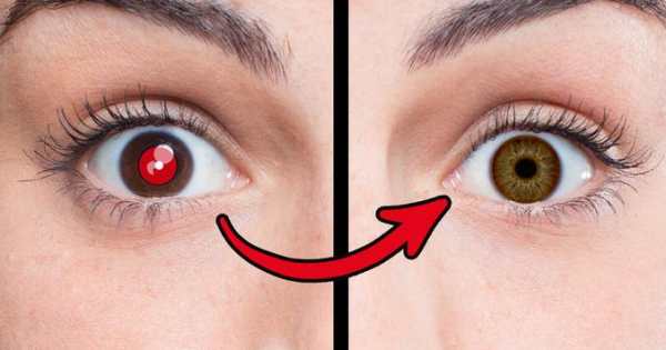 Red Eye Remover 1 تصوير الشاشة