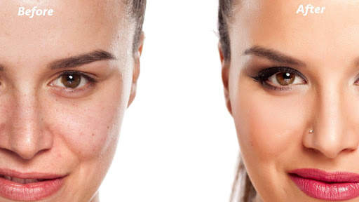 Pimple Eraser Photo Editor screenshot 4