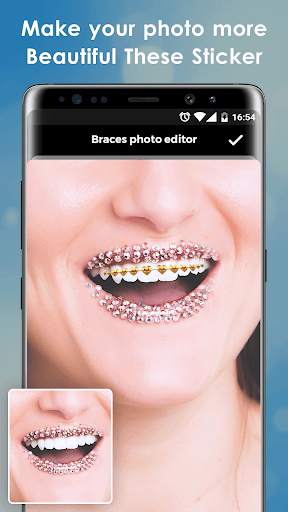 Teeth Braces Photo Booth screenshot 5
