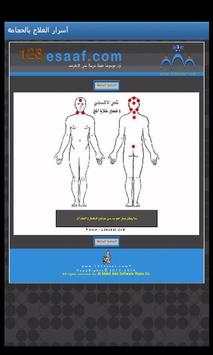 أسرار العلاج بالحجامة - تجريبى 4 تصوير الشاشة