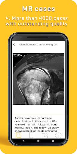 MRI Essentials screenshot 4