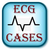 ECG Cases