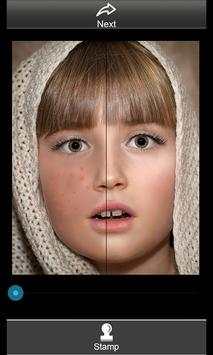 Photo Face Wash Beauty screenshot 2