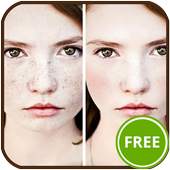 Blemish Remover 1.4.8