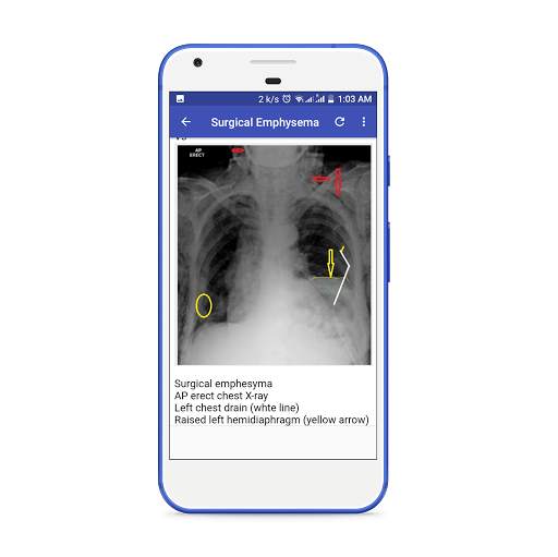 X-Ray Interpretation Guide screenshot 5