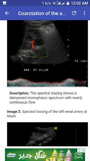 Ultrasound Guide A2Z 5 تصوير الشاشة