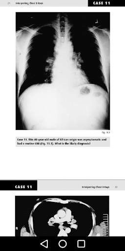 Medical X-Ray Interpretation w screenshot 6