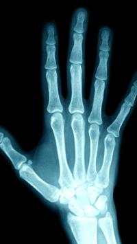 X-Ray Scanner screenshot 5