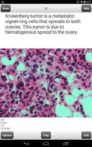 USMLE Step 2 CK Cards Lite screenshot 13
