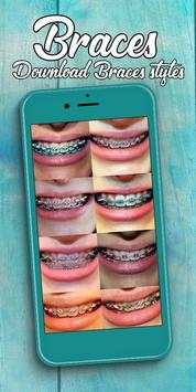 Braces screenshot 6