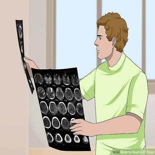 CT Brain Interpretation 4.5
