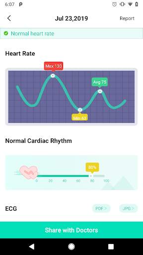 SnapECG screenshot 3