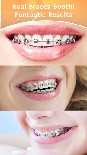 Teeth Braces Photo editor screenshot 3