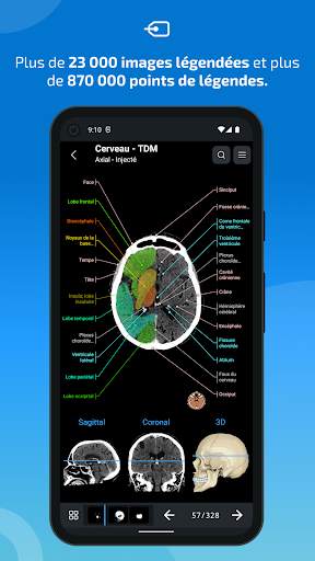 e-Anatomy screenshot 2