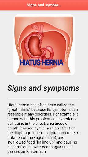 Hiatus Hernia Disease screenshot 5