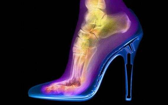X-ray screenshot 3