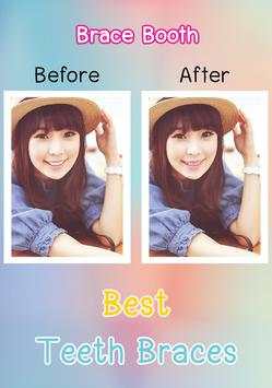 Beauty Plus Brace Camera HD screenshot 1