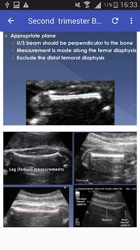 2nd & 3rd trimester OB/GY Ultrasound 5 تصوير الشاشة