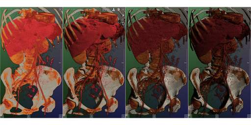 DroidRender - 3D DICOM viewer स्क्रीनशॉट 16