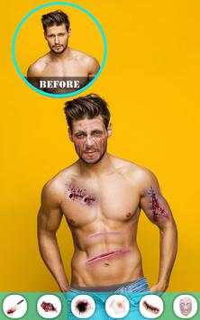 Injury Photo Editor скриншот 10