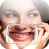 Brace my Photo icon
