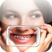 Brace my Photo logo