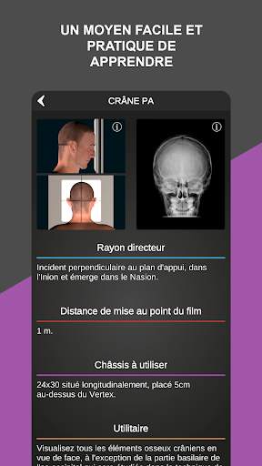 RX - Radiological Positions screenshot 3