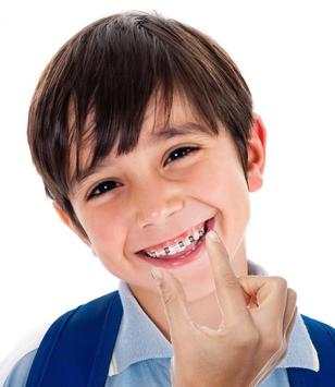 Fake Braces  Photo Editor screenshot 2