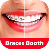Braces Photo Editor 2018 1.0