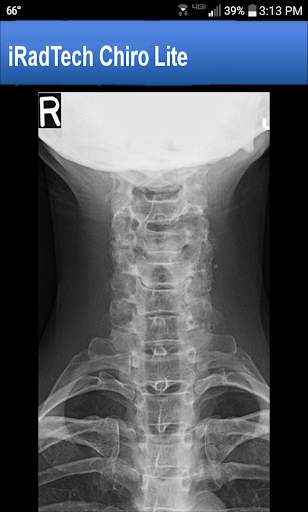 iRadTech Chiro Lite screenshot 5
