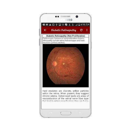 Ophthalmology Guide screenshot 7
