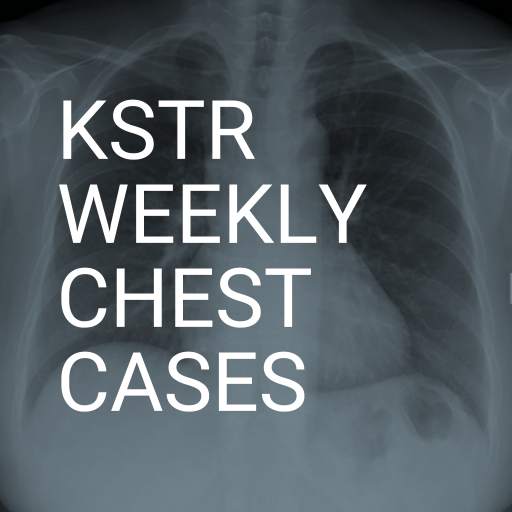 KSTR Weekly Chest Cases 4.2
