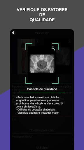 RX - Radiologia Posicionamento screenshot 6
